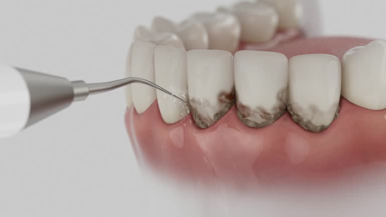 Reliable Tooth Extraction contractor in Hampton County County, SC by Dentist Open Now